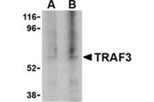 Western blot analysis of TRAF3 in 3T3 cell lysate with this product at (A) 1, and (B) 2 μg/ml. (TRAF3 Antikörper  (C-Term))