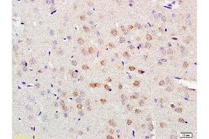 Formalin-fixed and paraffin embedded rat brain tissue labeled with Anti-LLGL1/2 Polyclonal Antibody, Unconjugated  at 1:200 followed by conjugation to the secondary antibody and DAB staining (LLGL1 Antikörper  (AA 801-900))