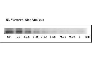 Image no. 4 for Signal Transducer and Activator of Transcription 1, 91kDa (STAT1) ELISA Kit (ABIN625243)