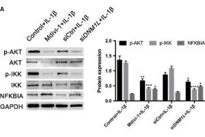 DNM1L deficiency attenuates the IL-1β-induced NF-κB activation in FLSs. (GAPDH Antikörper)