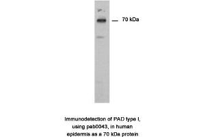 Image no. 1 for anti-Peptidyl Arginine Deiminase, Type I (PADI1) antibody (ABIN346990) (PADI1 Antikörper)