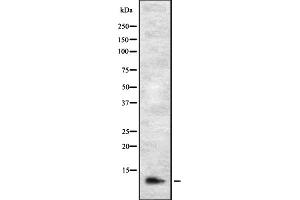 Western blot analysis of DIRC1 expression in HEK293 cells ,The lane on the left is treated with the antigen-specific peptide. (DIRC1 Antikörper)