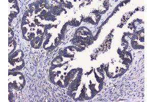 IHC analysis of RALBP1 using anti-RALBP1 antibody (ABIN5692936). (RALBP1 Antikörper  (AA 239-506))