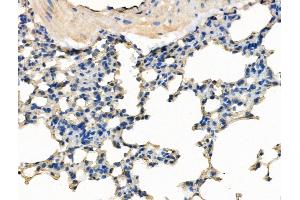 ABIN7094559 and ABIN7098608 at 1/100 staining Mouse lung tissue by IHC-P. (SMCHD1 Antikörper  (C-Term))
