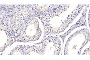 Immunohistochemistry (IHC) image for anti-Leptin (LEP) (AA 29-160) antibody (ABIN7429871)