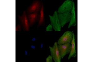 ABIN6257848 and ABIN6273703 staining  cells by IF/ICC.