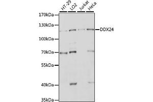 Western blot analysis of extracts of various cell lines, using DDX24 antibody (ABIN7266691) at 1:1000 dilution. (DDX24 Antikörper  (AA 510-859))