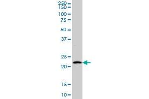 BARX1 monoclonal antibody (M05), clone 3C11 Western Blot analysis of BARX1 expression in Hela S3 NE . (BARX1 Antikörper  (AA 1-100))