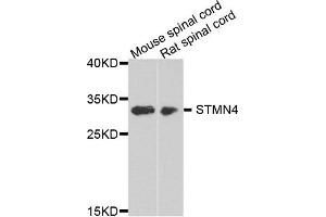 Western blot analysis of extract of mouse spinal cord and rat spinal cord cells, using STMN4 antibody. (STMN4 Antikörper)