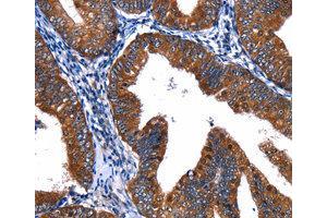 Immunohistochemistry (IHC) image for anti-Cullin 4A (CUL4A) antibody (ABIN1872121) (Cullin 4A Antikörper)