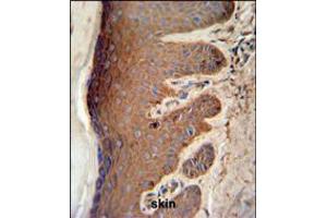 PKM2 Antibody (C-term L398) IHC analysis in formalin fixed and paraffin embedded skin tissue followed by peroxidase conjugation of the secondary antibody and DAB staining. (PKM2 Antikörper  (C-Term))