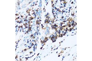 Immunohistochemistry (Paraffin-embedded Sections) (IHC (p)) image for anti-Sialophorin (SPN) (AA 276-400) antibody (ABIN6148363)