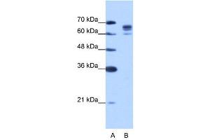 Western Blotting (WB) image for anti-DEAD (Asp-Glu-Ala-Asp) Box Polypeptide 17 (DDX17) (N-Term) antibody (ABIN2776581)