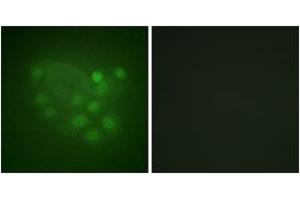Immunofluorescence analysis of A549 cells, using KIF2C (Ab-95) Antibody. (KIF2C Antikörper  (AA 61-110))