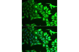 Immunofluorescence analysis of HeLa cells using AIPL1 antibody (ABIN5973857). (AIPL1 Antikörper)