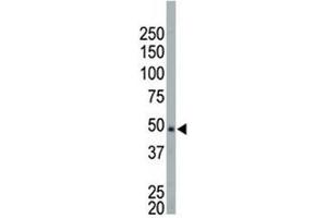 NEK2 antibody used in western blot to detect NEK2 in HeLa cell lysate (NEK2 Antikörper  (AA 350-382))