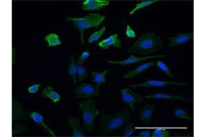 Immunofluorescence of monoclonal antibody to UMPS on HeLa cell. (UMPS Antikörper  (AA 381-479))