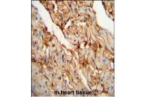 MYOZ1 Antibody (Center) (ABIN651441 and ABIN2840243) immunohistochemistry analysis in formalin fixed and paraffin embedded mouse heart tissue followed by peroxidase conjugation of the secondary antibody and DAB staining. (Myozenin 1 Antikörper  (AA 40-69))