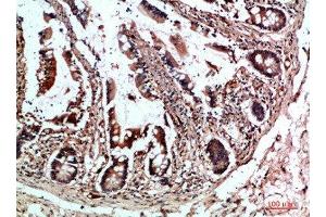 Immunohistochemical analysis of paraffin-embedded human-colon, antibody was diluted at 1:200 (CYFIP2 Antikörper  (AA 1171-1220))