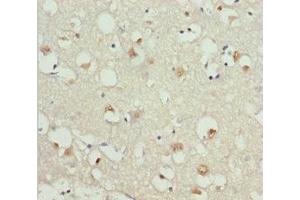 Immunohistochemistry of paraffin-embedded human brain tissue using ABIN7154698 at dilution of 1:100 (GNAO1 Antikörper  (AA 60-180))