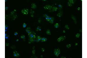Image no. 10 for anti-Amyloid beta (A4) Precursor Protein (APP) antibody (ABIN1496877) (APP Antikörper)