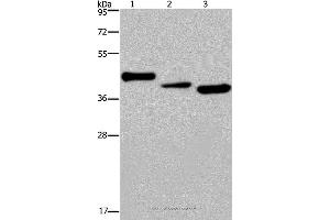 Western blot analysis of Mouse heart tissue, A549 and HepG2 cell, using CYR61 Polyclonal Antibody at dilution of 1:300 (CYR61 Antikörper)
