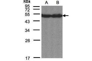 WB Image Sample(30 μg of whole cell lysate) A:Hep G2, B:MOLT4 , 12% SDS PAGE antibody diluted at 1:1500 (CREB3L1 Antikörper  (C-Term))