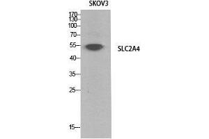 Western Blot (WB) analysis of SKOV3 cells using Glut4 Polyclonal Antibody.