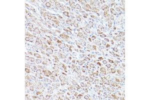 Immunohistochemistry (IHC) image for anti-BCL2-Related Ovarian Killer (BOK) (AA 1-100) antibody (ABIN7265866)