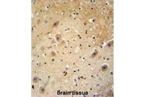 Immunohistochemistry (Paraffin-embedded Sections) (IHC (p)) image for anti-DDB1 and CUL4 Associated Factor 13 (DCAF13) (AA 372-402), (C-Term) antibody (ABIN955570)