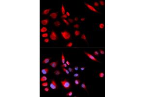 Immunofluorescence (IF) image for anti-Kinesin Family Member 2C (KIF2C) antibody (ABIN1876637) (KIF2C Antikörper)