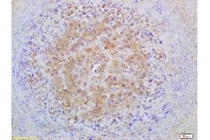 Formalin-fixed and paraffin embedded mouse lymphoma labeled with Anti-Smad3 Polyclonal Antibody, Unconjugated  at 1:200 followed by conjugation to the secondary antibody and DAB staining