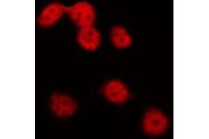 ABIN6275731 staining Hela by IF/ICC. (NKX2-8 Antikörper  (N-Term))