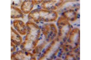 Used in DAB staining on fromalin fixed paraffin-embedded Kidney tissue (PDGF-AA Homodimer (AA 90-190) Antikörper)