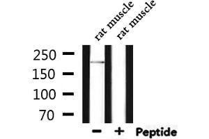 Western blot analysis of extracts from rat muscle, using DOCK7 Antibody.