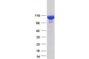 Western Blotting (WB) image for PITPNM Family Member 3 (PITPNM3) protein (Myc-DYKDDDDK Tag) (ABIN2729025)