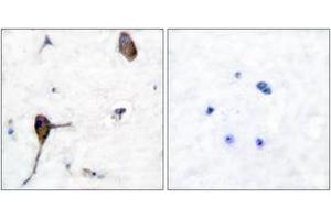 Immunohistochemistry analysis of paraffin-embedded human brain tissue, using IL-3R beta (Ab-593) Antibody. (CSF2RB2 Antikörper  (AA 559-608))