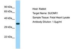 Image no. 1 for anti-Succinate Receptor 1 (SUCNR1) (AA 161-210) antibody (ABIN6750142) (SUCNR1 Antikörper  (AA 161-210))