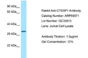 Western Blotting (WB) image for anti-CTD (Carboxy-terminal Domain, RNA Polymerase II, Polypeptide A) Small Phosphatase 1 (CTDSP1) (N-Term) antibody (ABIN2774415) (CTDSP1 Antikörper  (N-Term))