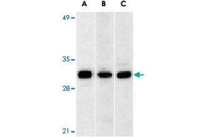 Western blot analysis of ANP32A expression in human Raji cell (A), mouse (B) and rat (C) testis tissue llysates with ANP32A polyclonal antibody  at 1 ug/mL . (PHAP1 Antikörper  (C-Term))