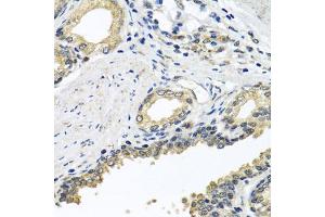Immunohistochemistry of paraffin-embedded human prostate using STXBP2 antibody (ABIN5975753) at dilution of 1/100 (40x lens). (STXBP2 Antikörper)