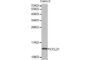 Western blot analysis of extracts of Caco-2 cell lysate, using CCL21 antibody. (CCL21 Antikörper  (AA 24-134))