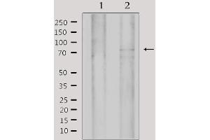 Western blot analysis of extracts from 293, using MYST2 Antibody.