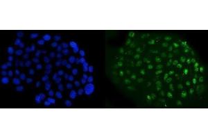 IF analysis of NFIB/NF1B2 using anti-NFIB/NF1B2 antibody (ABIN7602995). (NFIB Antikörper  (Middle Region))