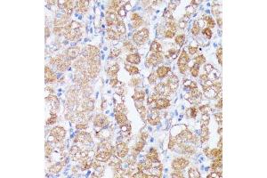 Immunohistochemistry of paraffin-embedded human stomach using SPON2 antibody (ABIN6129679, ABIN6148370, ABIN6148372 and ABIN6215647) at dilution of 1:100 (40x lens). (SPON2 Antikörper  (AA 27-150))