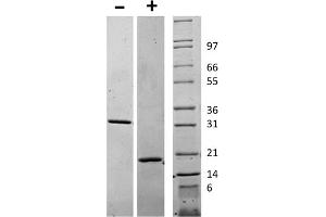 SDS-PAGE of Human Macrophage Colony Stimulating Factor Recombinant Protein SDS-PAGE of Human Macrophage Colony Stimulating Factor Recombinant Protein. (M-CSF/CSF1 Protein)
