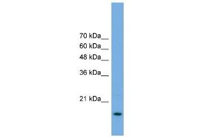 WB Suggested Anti-POP5 Antibody Titration: 0. (POP5 Antikörper  (Middle Region))