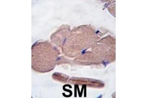 Immunohistochemistry (IHC) image for anti-Myostatin (MSTN) antibody (ABIN2916193) (MSTN Antikörper)