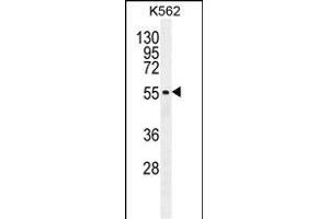 Western Blotting (WB) image for anti-Microphthalmia-Associated Transcription Factor (MITF) (AA 1-28), (N-Term) antibody (ABIN655506)