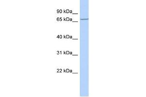 WB Suggested Anti-LRCH4 Antibody Titration:  0. (LRCH4 Antikörper  (Middle Region))